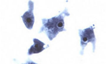 ネグレリア・フォーレリ原生微生物